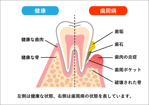 アテ