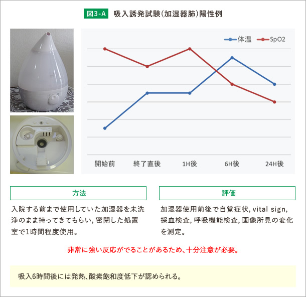 吸入誘発試験（加湿器肺）陽性例。 A)吸入6時間後には発熱、酸素飽和度低下が認められる。