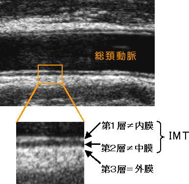 総頚動脈